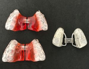 ortodoncia en Santa Coloma de Gramenet