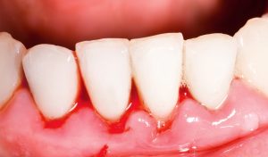 urgencias dentales Santa Coloma de Gramenet